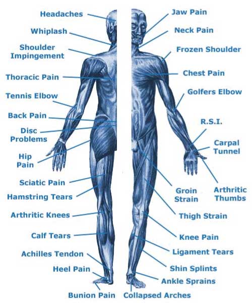 Body Injury Chart
